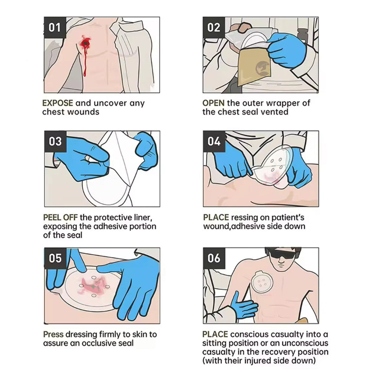 A chest seal is indicated when a patient has penetrating chest trauma from neck to navel, on the front, side or back of the chest. The chest seal doesn't control bleeding inside the chest cavity. Instead, the chest seal prevents air from entering the chest cavity. www.moralepatches.com.au